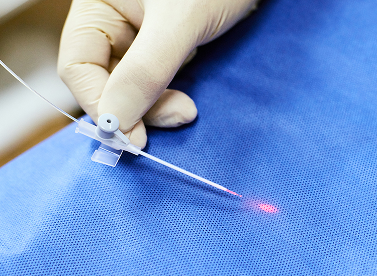 Ενδοφλέβιο laser: η πλέον εξελιγμένη και ασφαλής θεραπεία της φλεβικής ανεπάρκειας και των κιρσών